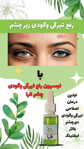 لوسیون رفع تیرگی و گودی زیر چشم تازه تولید نمونه اصل