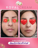 کرم ضدلک قوی ژل رویال آواطب ۲۰ گرم نمونه اصل برای آقایان و بانوان