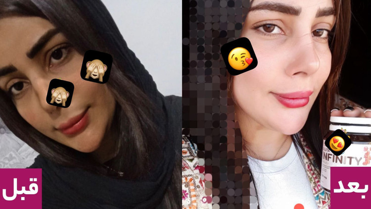 مکمل سفید کننده گلوتا اینفینیتی | گلوتاتیون دوز 1000 نسخه اصلی