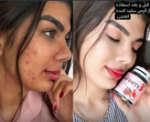 مکمل سفید کننده گلوتا اینفینیتی | گلوتاتیون دوز 1000 نسخه اصلی