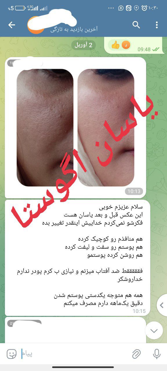 کرم سه کاره یاسان آگوستا | لیفتینگ و برطرف کننده منافذ