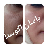 کرم سه کاره یاسان آگوستا | لیفتینگ و برطرف کننده منافذ