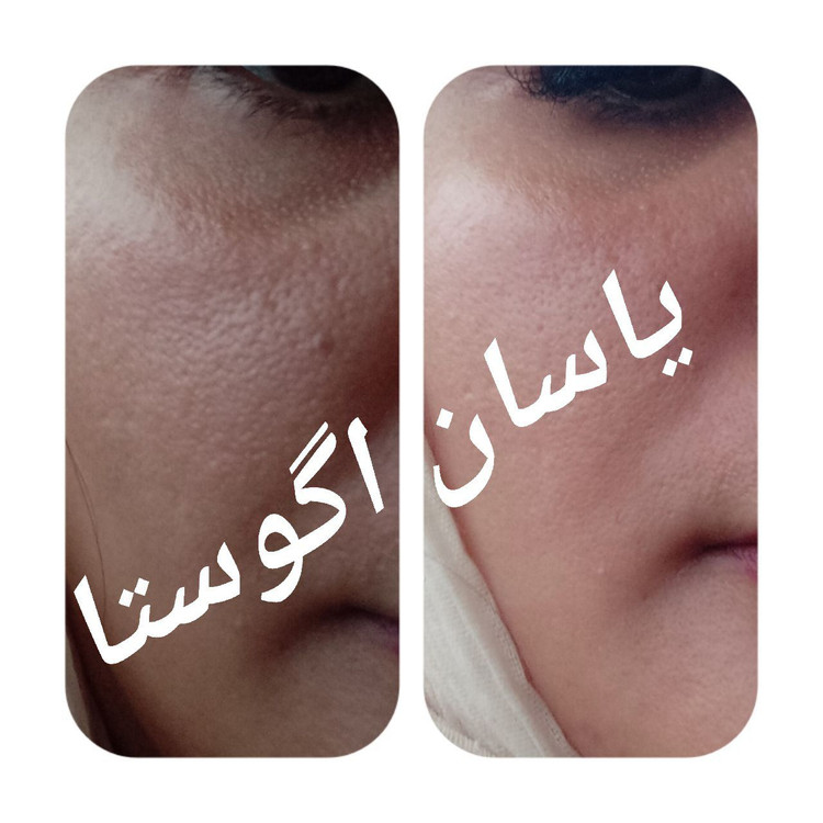 کرم سه کاره یاسان آگوستا | لیفتینگ و برطرف کننده منافذ